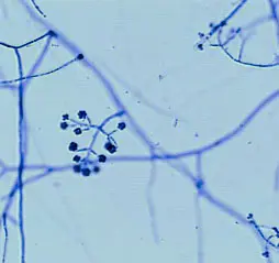 Biotic Problems disease in Middle Tennessee