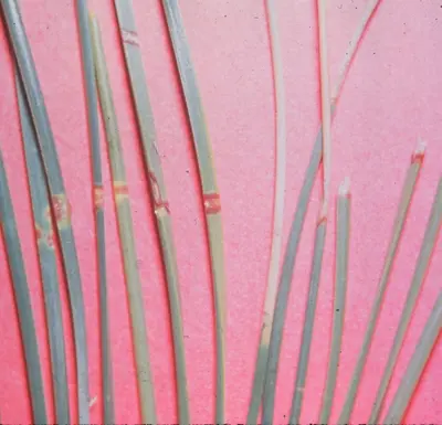 Needle Blights disease in Middle Tennessee