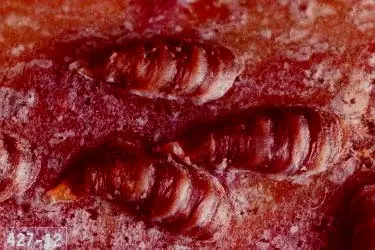 Scales disease in Middle Tennessee