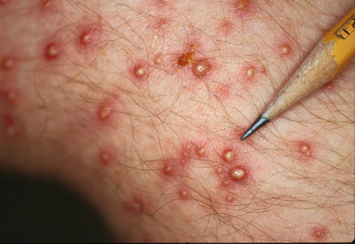 Impact of Fire Ants — photo 2