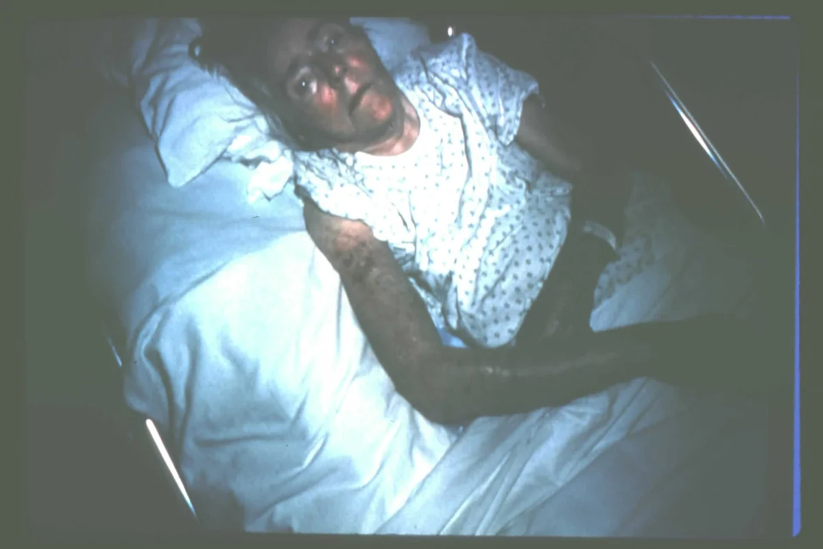 Impact of Fire Ants — photo 4