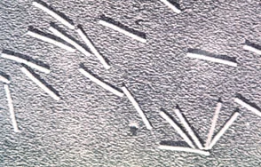 Bacteria — photo 2