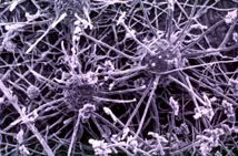 Prior disease in Middle Tennessee