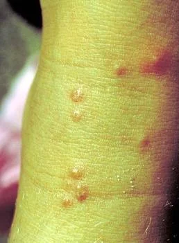 Medical Importance — photo 3