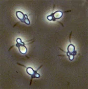 Entomosporium Leaf Spot — photo 3