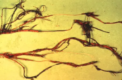 Wet Root Rot (Correct cultural problems) in Middle Tennessee
