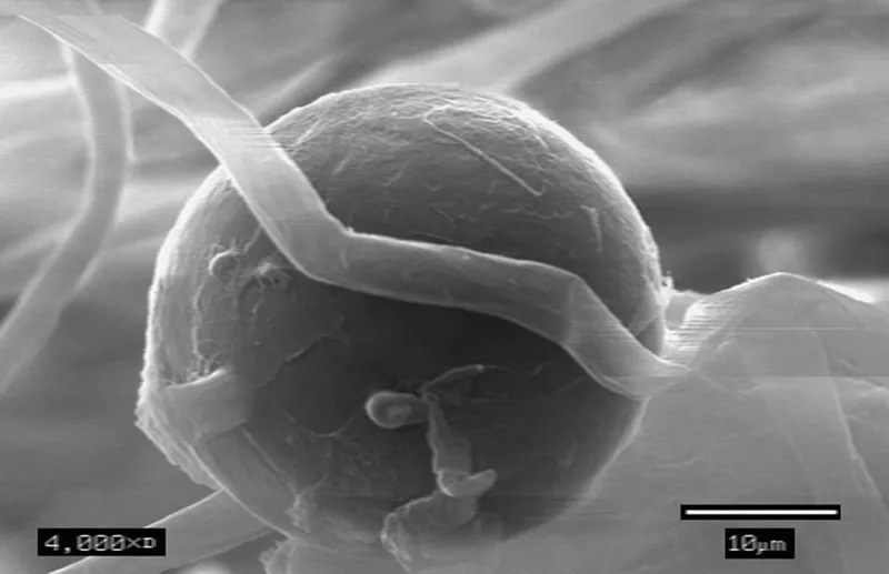 Phytophthora plant disease in Middle Tennessee